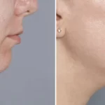 Double Chin Exercises: 5 Quick Moves to Firm Face in 30s