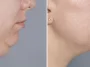 Double Chin Exercises: 5 Quick Moves to Firm Face in 30s